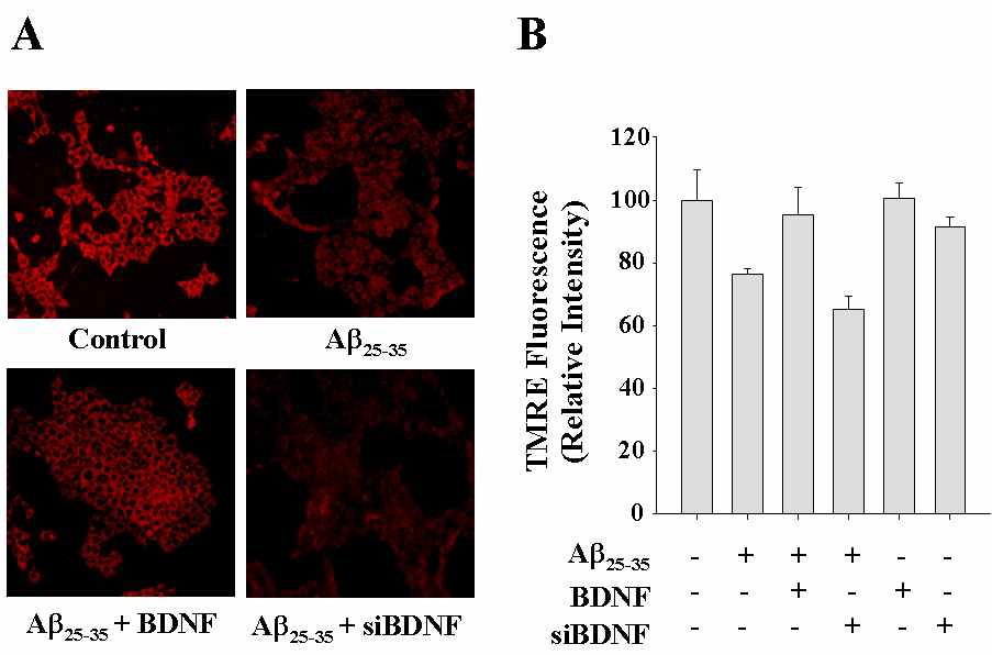 Fig. 4 Effects of up-regulation or down-regulation of BDNF on the Aβ25-35-induced dissipation of MMP