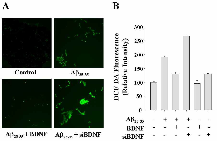 Fig. 6 Effects of up-regulation or down-regulation of BDNF on the Aβ25-35-induced intracellular accumulation of ROS
