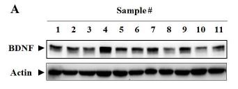 Fig. 9A Effect of marine natural products on the protein expression of BDNF