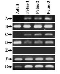 RT-PCR 결과 A: Mitochondrial Fl-Atpase; B: Heart shock protein β-1; C: 14-3-3 protein epsilon; D: Voltage-dependent selective channel protein 2; E: alpha-cardiac actin; F: Succinyl-CoA:3-ketoacid-coenzyme A; G: GAPDH