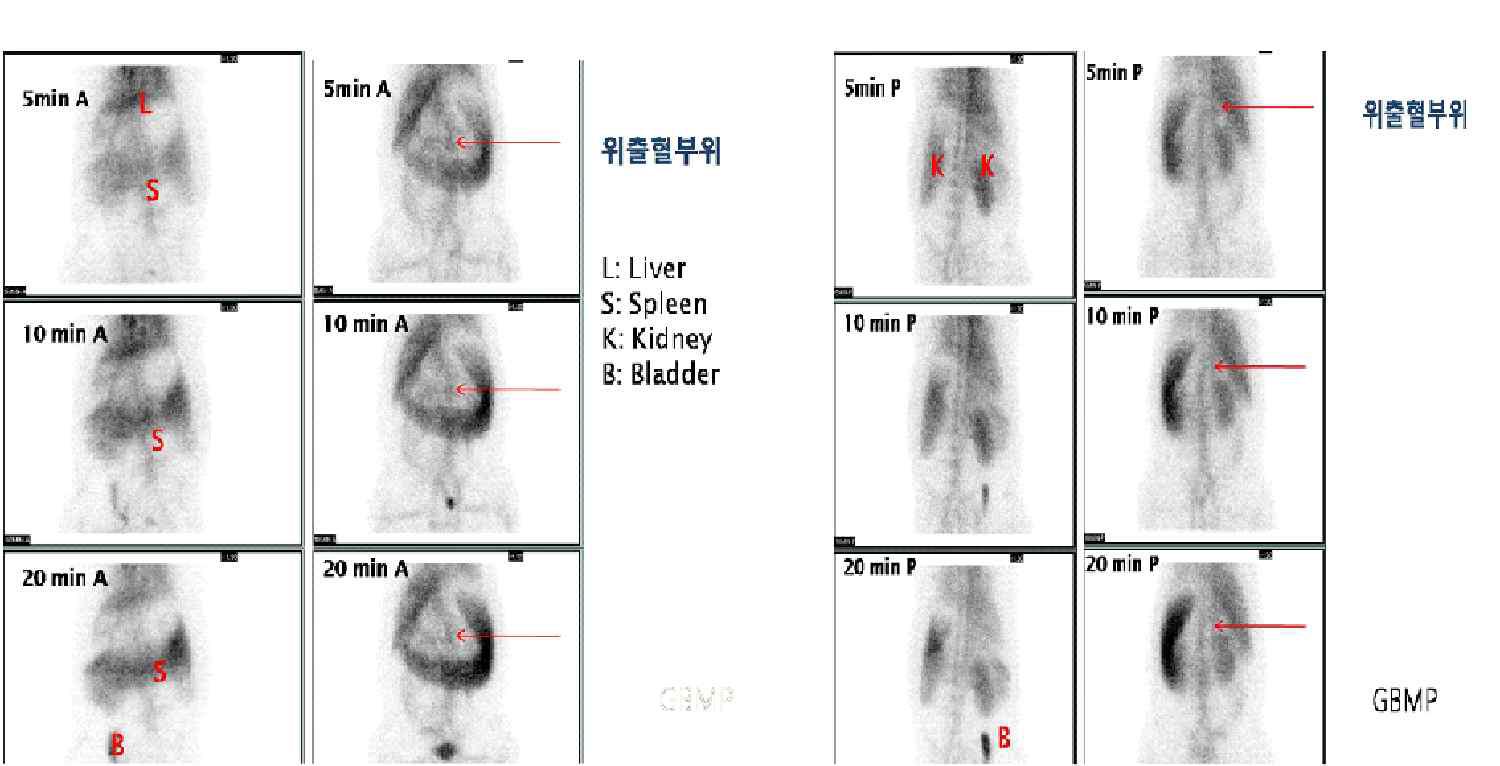 위출혈 돼지에서의 스캔. 앞쪽 (좌), 뒤쪽 (우)