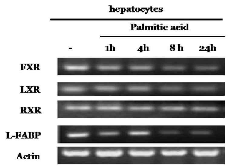 간세포에서 palmitic acid 처리시 지질 대사 관련 mRNA의 발현 변화