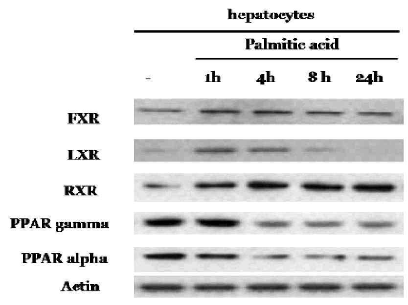 간세포에서 palmitic acid 처리시 지질 대사 관련 단백질의 발현 변화