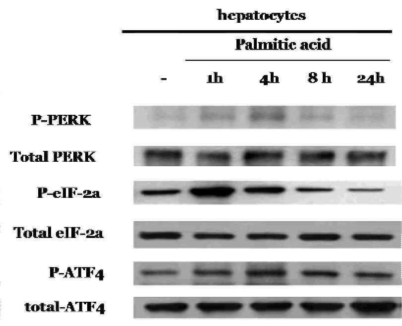 간세포에서 palmitic acid에 의한 PERK, eIF-2α, 및 ATF-4의 변화