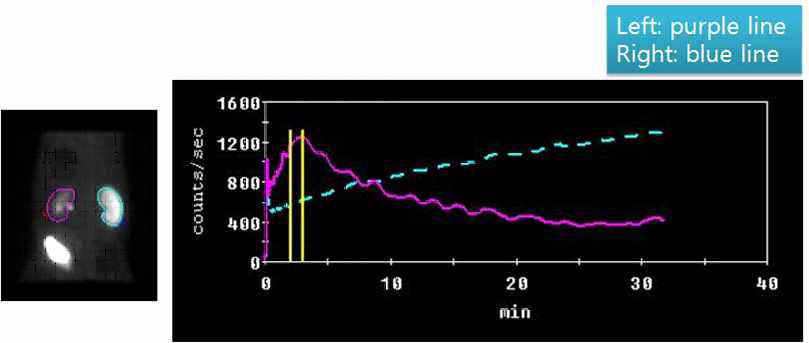 일측성 요관결찰을 실시한 미니돼지에서의 기능 곡선