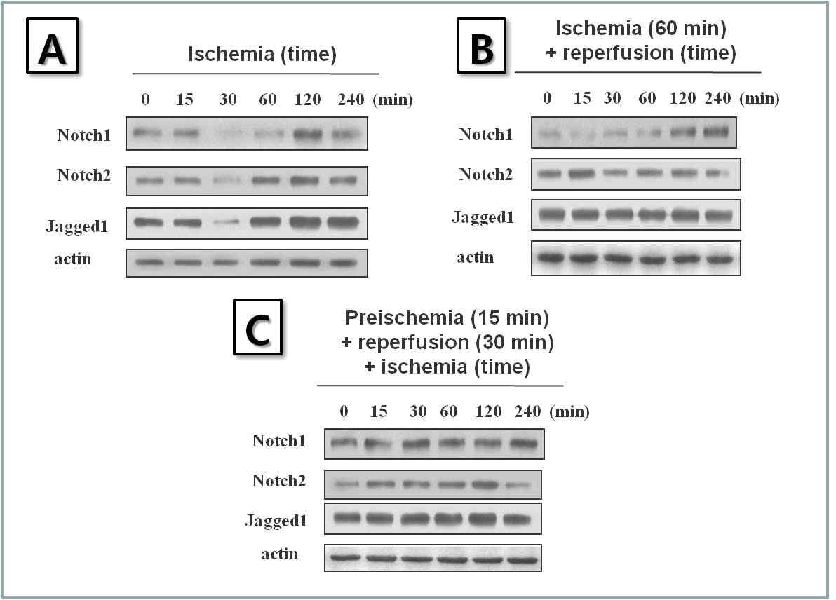 폐 허혈, 재관류 및 preischemic 조건 후 재관류 실시 후 허혈 유도모델에서의 notch-1,notch-2 및 jagged-1의 단백질 발현 변화