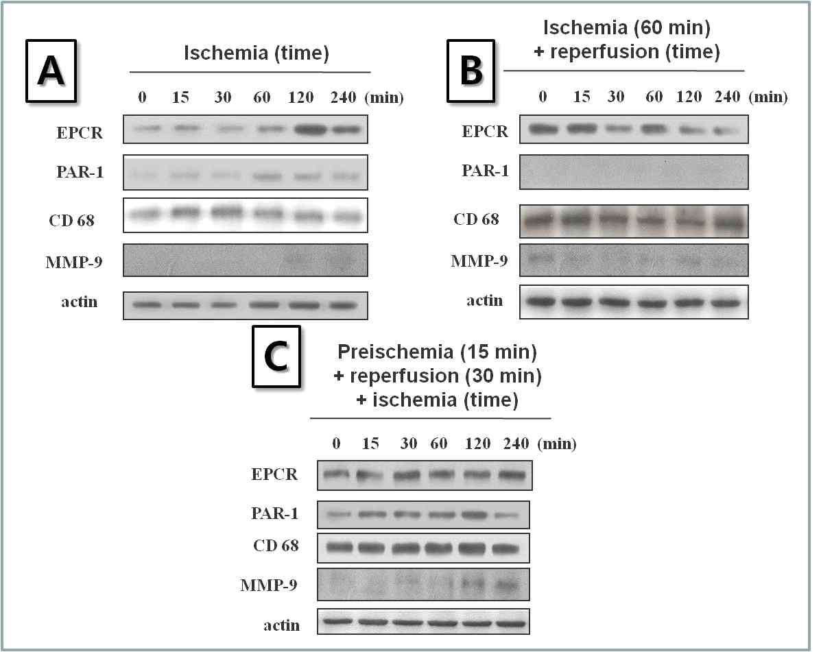 폐허혈, 재관류및 preischemic 조건후재관류실시후허혈 유도모델에서의EPCR, PAR-1, CD 68 및MMP-9의단백질발현변화.