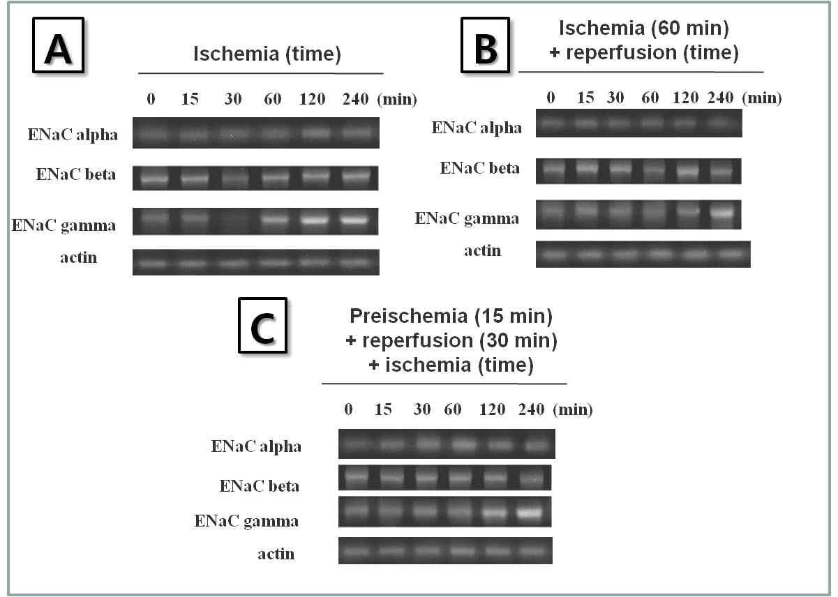 폐 허혈, 재관류 및 preischemic 조건 후 재관류 실시 후 허혈 유도모델에서의 ENaC α, β, γ의 유전자 발현 변화.