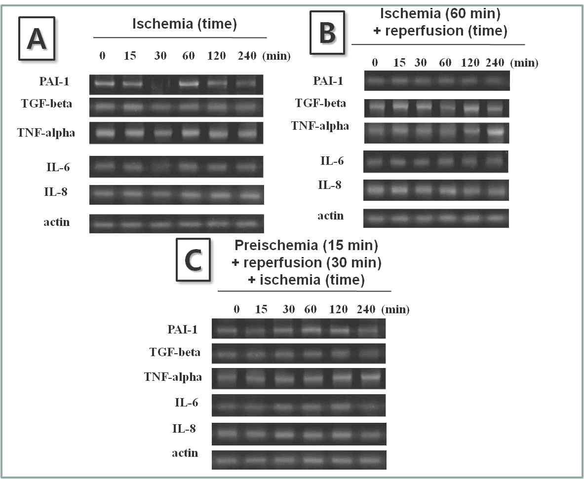 폐허혈, 재관류및 preischemic 조건후재관류실시후허혈 유도모델에서의PAI-1, TGF-β, TNF-α, IL-6, IL-8 유전자발현변화
