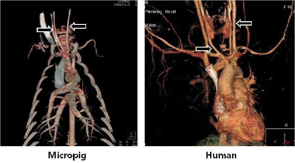미니돼지와 사람의 총목동맥 형태학적 비교