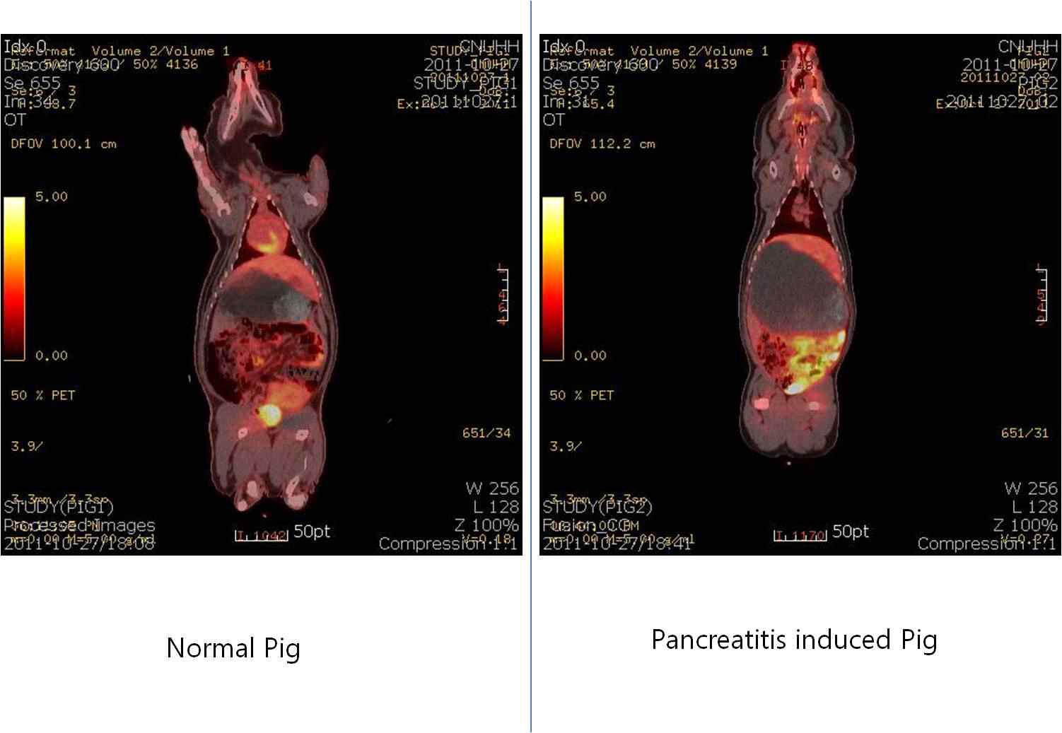 정상 미니돼지와 췌장염 유발 미니돼지에서 PET-CT의 영상에서 앙와위에 의한 췌장 영상