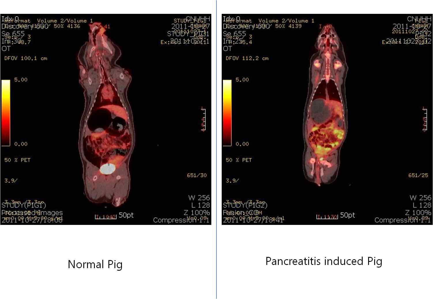 정상 미니돼지와 췌장염 유발 미니돼지에서 PET-CT의 영상에서 oblique 면에 의한 췌장 영상