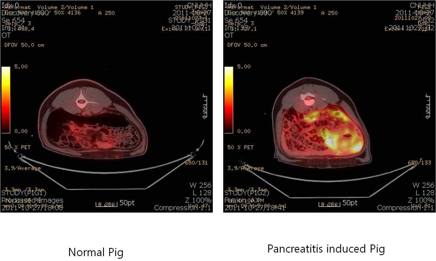 정상 미니돼지와 췌장염 유발 미니돼지에서 PET-CT의 영상에서 횡단에 의한 영상