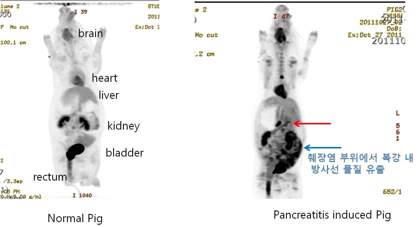 정상돼지 군과 췌장염 유발 돼지군에서의 PET-CT의 융합 이미지.