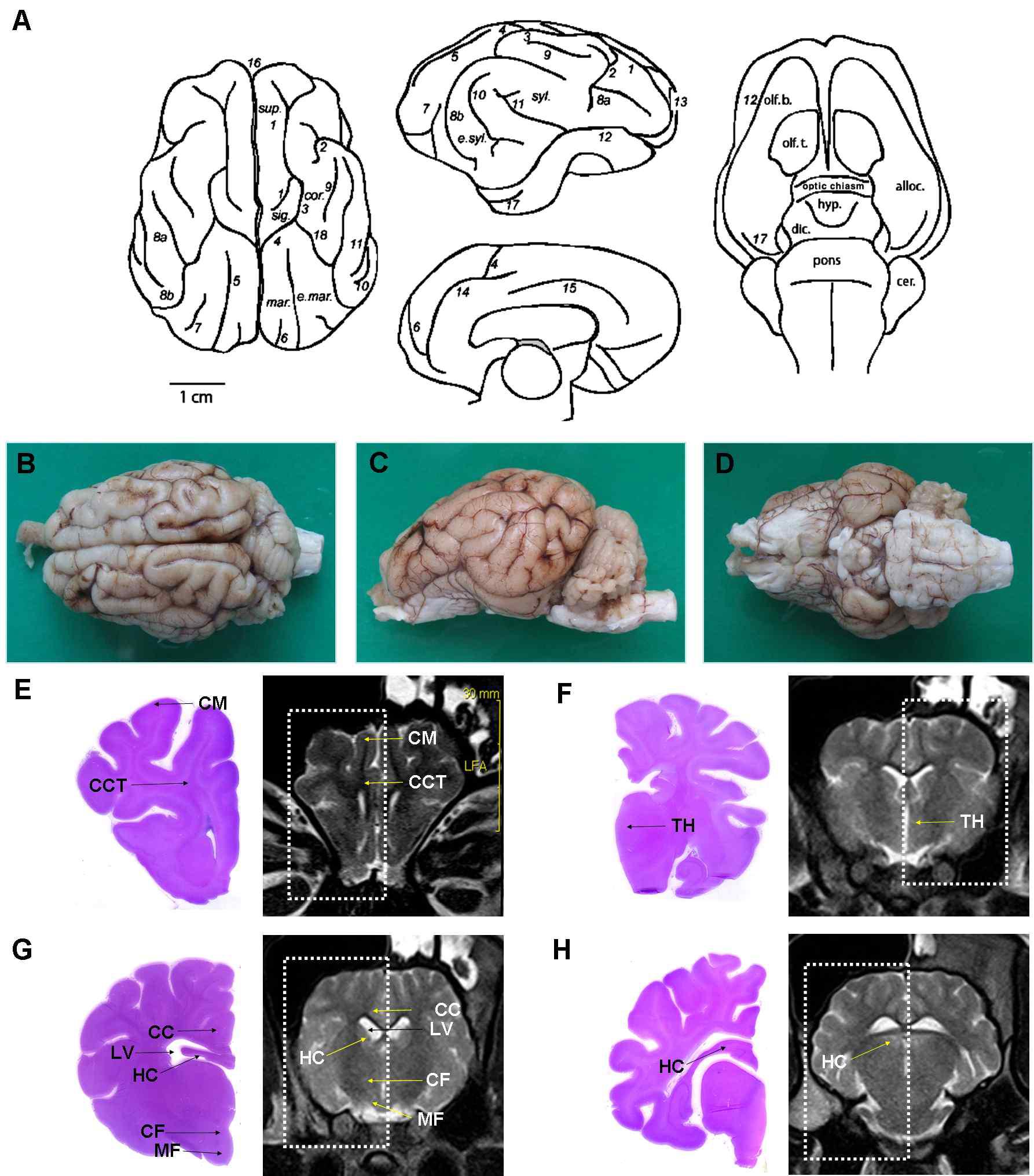(A) 미니돼지 뇌의 모식도, (B) 앞쪽, (C) 외측, 그리고 (D) 아래쪽 뇌의 해부학적 구조. (E-H) 정상 미니돼지 뇌의 조직학적 사진 및 자기공명영상의 비교