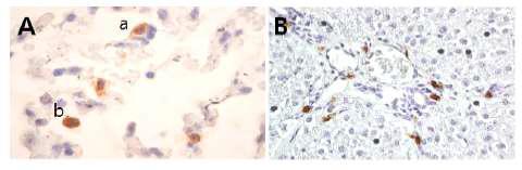 미니돼지의 폐(A) 및 간조직(B)의 면역염색 상 Pulmonary 혈관내 대식세포 (a), 폐포 대식세포 (b) 및 Kupffer 세포 (B)가 관찰됨.