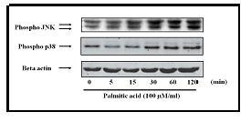 돼지 간세포에서 palmitic acid에 의한 p38 MAPK 및 JNK 활성에 대한 시간 의존성