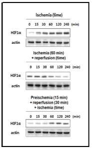 폐 허혈, 재관류 및 preischemic 조건 후 재관류 실시 후 허혈 유도모델에서의 HIF-1α의 단백질 발현 변화