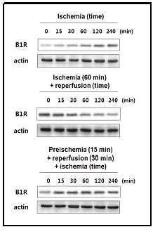 폐 허혈, 재관류 및 preischemic 조건 후 재관류 실시후 허혈 유도모델에서의 B1R의 단백질 발현 변화
