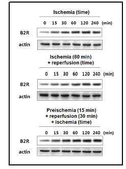 폐 허혈, 재관류 및 preischemic 조건 후 재관류 실시후 허혈 유도모델에서의 B2R의 단백질 발현 변화