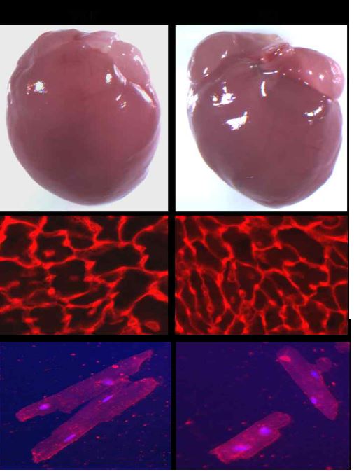 그림 4. CAR 제거 생쥐의 심근세포 성장저해