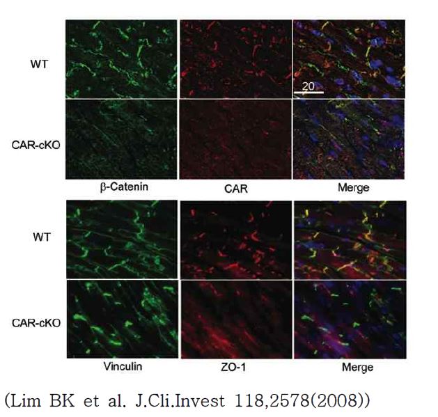 그림4. CAR 단백질 제거 생쥐 심장의 면역형광염색