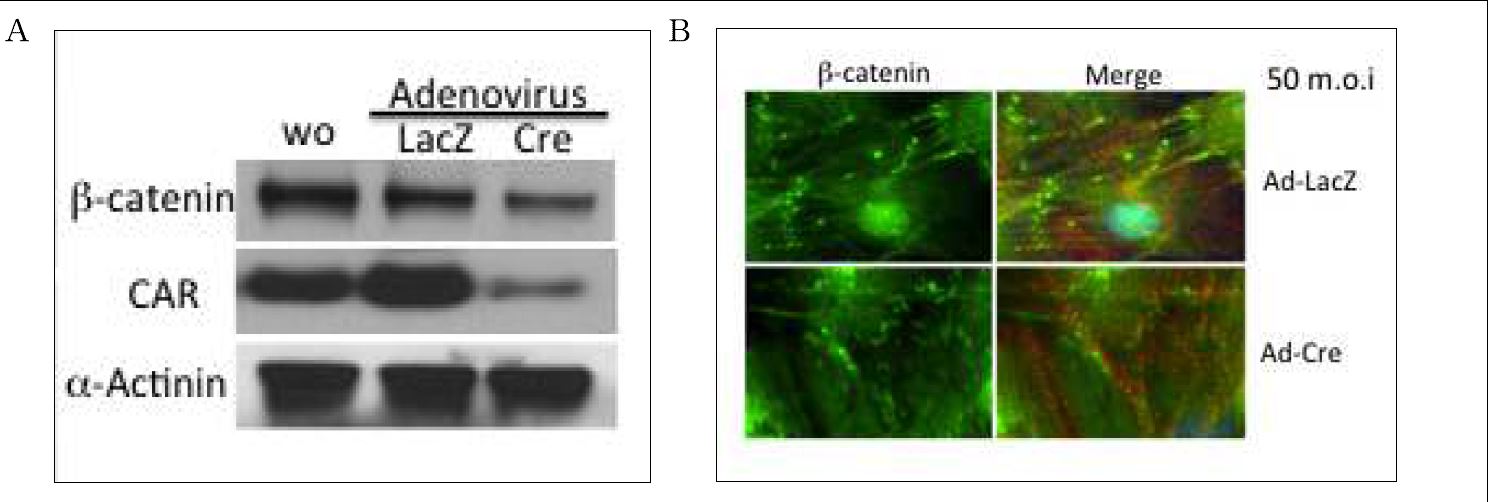 그림 2. 배양심근 세포에서 CAR 단백질 제거에 의한 β-catenin 파괴