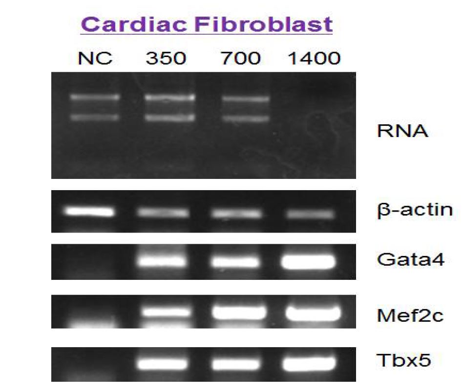 그림 14 아데노 바이러스로 감염된 심근세포의 GMT qRT-PCR 결과