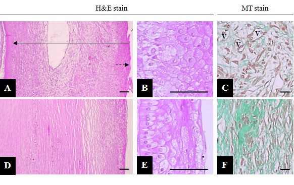 Fig 4. The representative histopathological profiles of Control (A~C) and MSC (D~F) groups