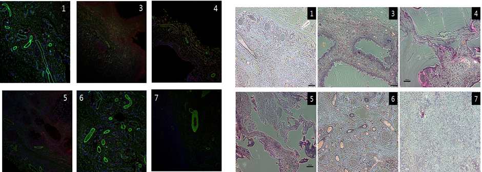 그림 9 왼쪽) 이식되었던 구조물의 면역조직화학법 결과, 오른쪽) 이식되었던 구조물의 H&E 염색 결과