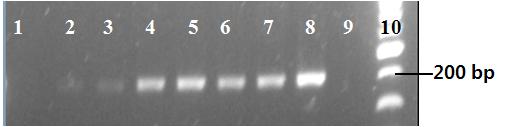 그림26. Agarose gel electrophoresis image illustrating validation of the immunoprove by RT-PCR for tyrosine hydroxylase detection