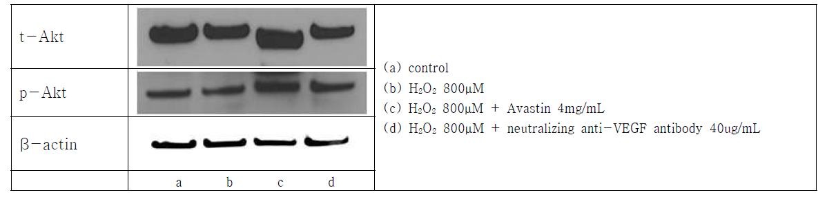 Avastin 또는 neutralizing anti-VEGF antibody 사용시 Akt phosphorylation 변화