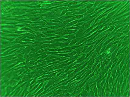 (좌측). primary retinal Müller cell (passage 5) (x100)