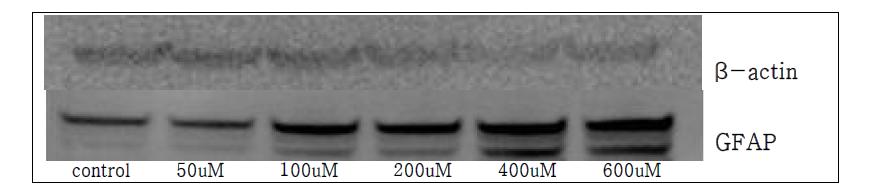 H2O2 처리 농도에 따른 망막 뮬러세포의 GFAP 단백질 발현 변화