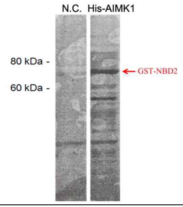 GST-NBD2를 기질로 이용하여 in vitro kinase assay를 진행하였다. AIMK1이 있는 실험구에서 GST-NBD2가 인산화 되었다