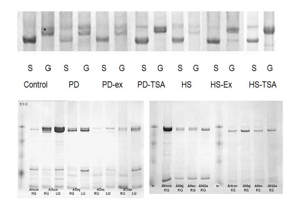 그림 7. 근육균질액에서 MHC isoform type 비율의 분석, MHC isoform의 분리 대표적인 그림, 상 청년군, 하, 노령군