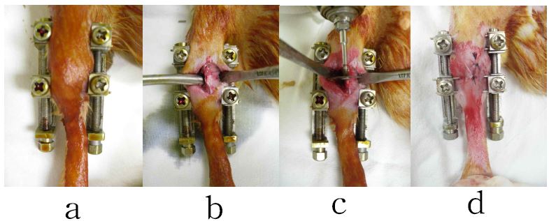 Fig.1 a. K-wire를 삽입하고 외고정 장치를 장착. b. 피부 및 골막 절개하여 경골 노출, c. hand piece를 이용하여 경골절골. d. 봉합사로 골막과 피부를 봉합