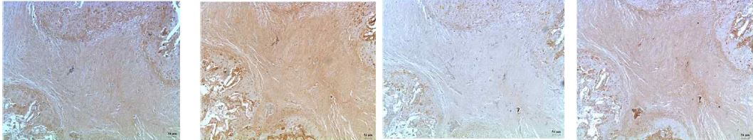 Fig.4 Rat bone 신연 후 3주 -hif1a , nanog , oct4 , VEGF- X100