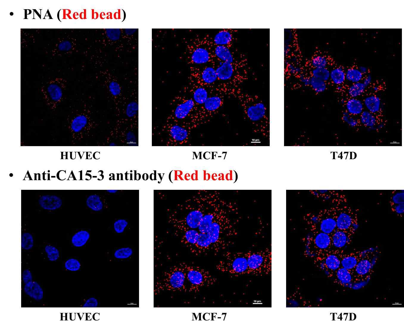 PNA lectin과 anti-CA15-3를 이용한정상세포 및 암세포의 측정 결과사진