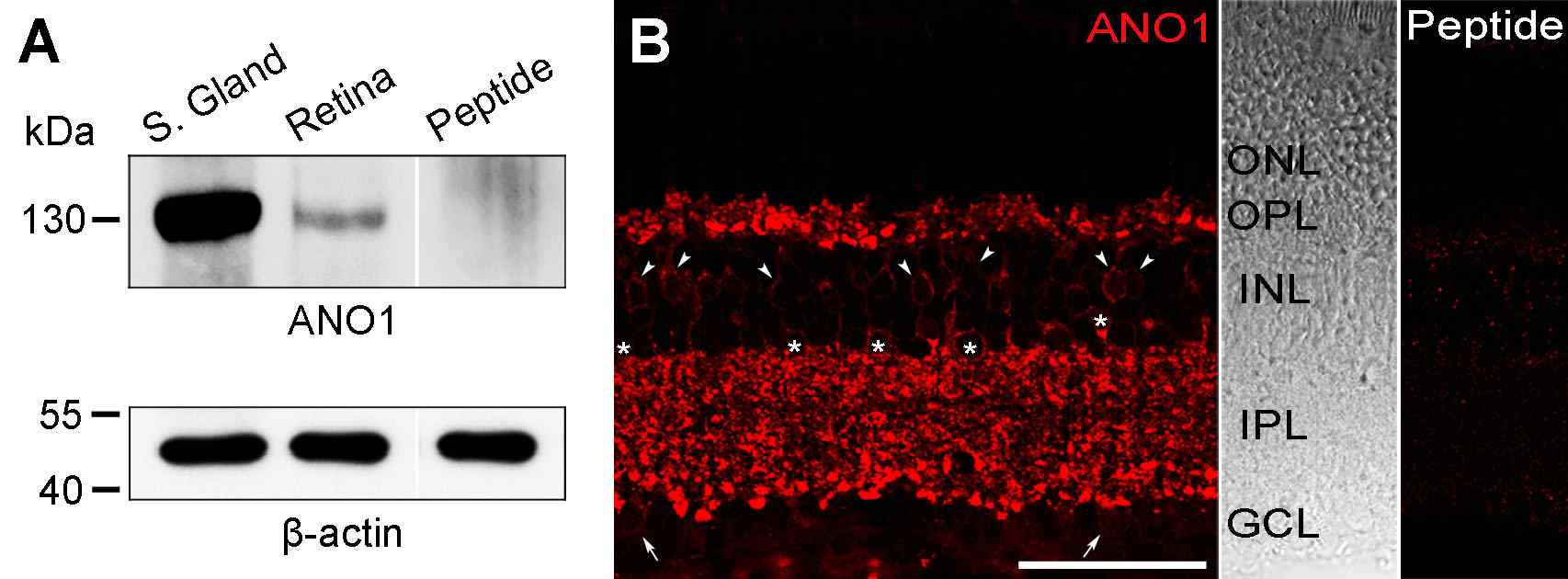 Fig . 1 . (EJxeporne sesti oanl .,o f2 0A1N3O) 1 i n th e mouse retina