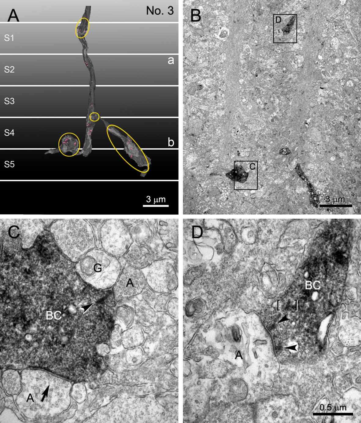 Fig. 5. 3D-reconstruction of an ON-cone bipolar cell and representative examples of axonal and conventional ribbon synapses (Kim et al. 2012)