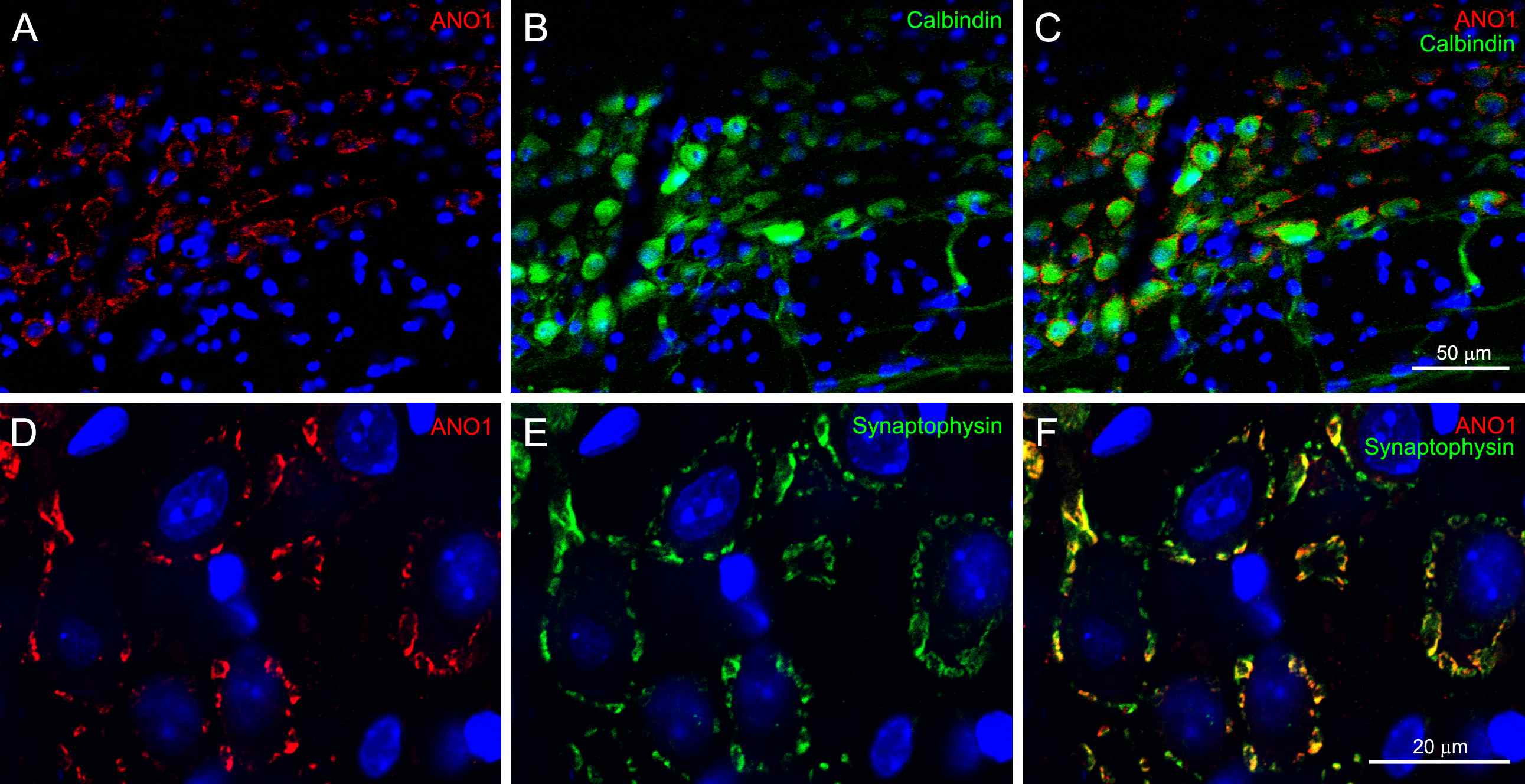 Fig. 8. Immunohistochemical localization ofANO1 in the trapezoid body