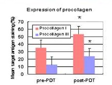 그림13) 광역학 치료 후 진피내 procollagen I 과 III의 발현 변화