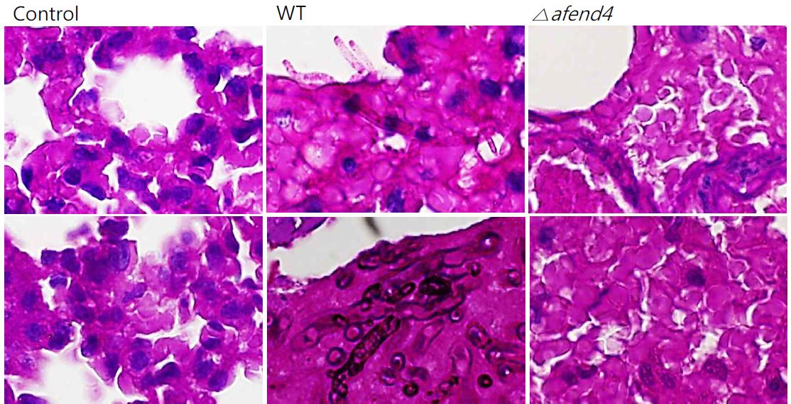 그림 7. Histopathological analysis of mouse lung