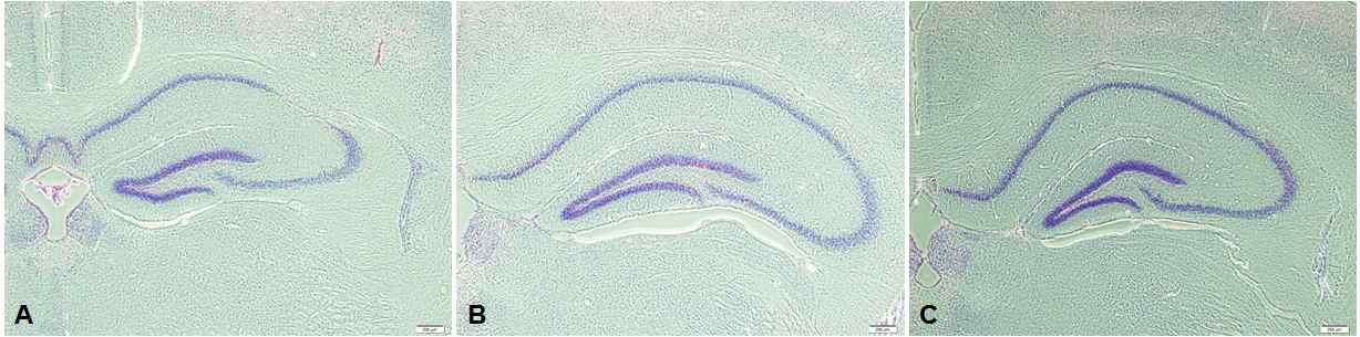 그림 16. Nissl body 염색을 통한 해마 신경세포 재생 분석