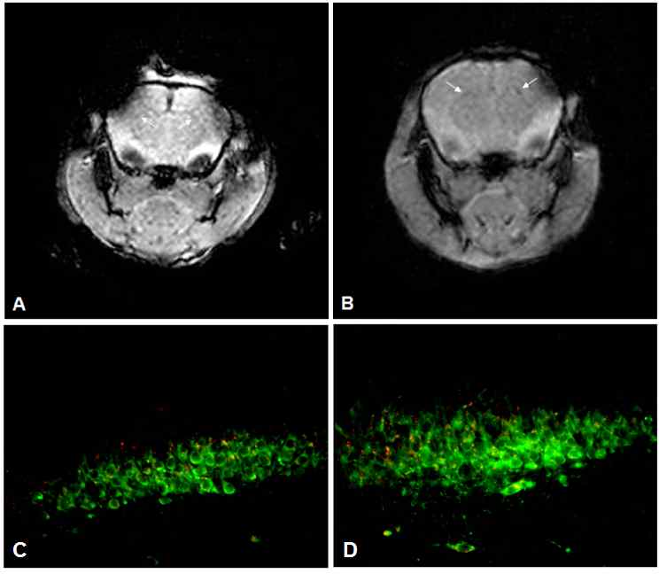 그림 2. MRI와 면역화학염색을 이용한 인지장애 모델에 이식한 나노입자 표지된 세포 호밍 추적 분석