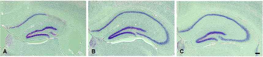 그림 4. Nissl body 염색을 통한 해마 신경세포 재생 분석