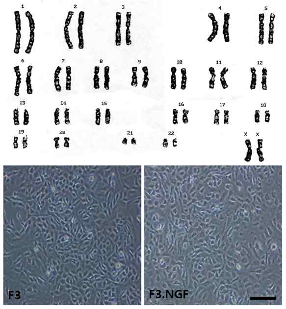 그림 2. 불멸화 인간신경줄기세포에 인간 NGF 유전자 탑재 인간신경줄기세포주 제작