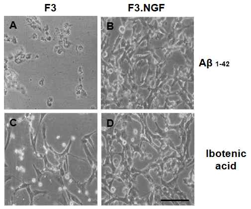 그림 5. Aβ1-42, ibotenic acid 처리 후 세포 사진
