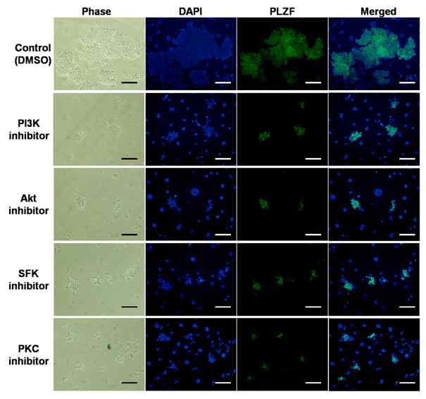 그림 4. 각각의 inhibitor 처리에서 8일간 배양된 정원줄기세포에서의 PLZF(정원줄기세포 마커) 발현 양상